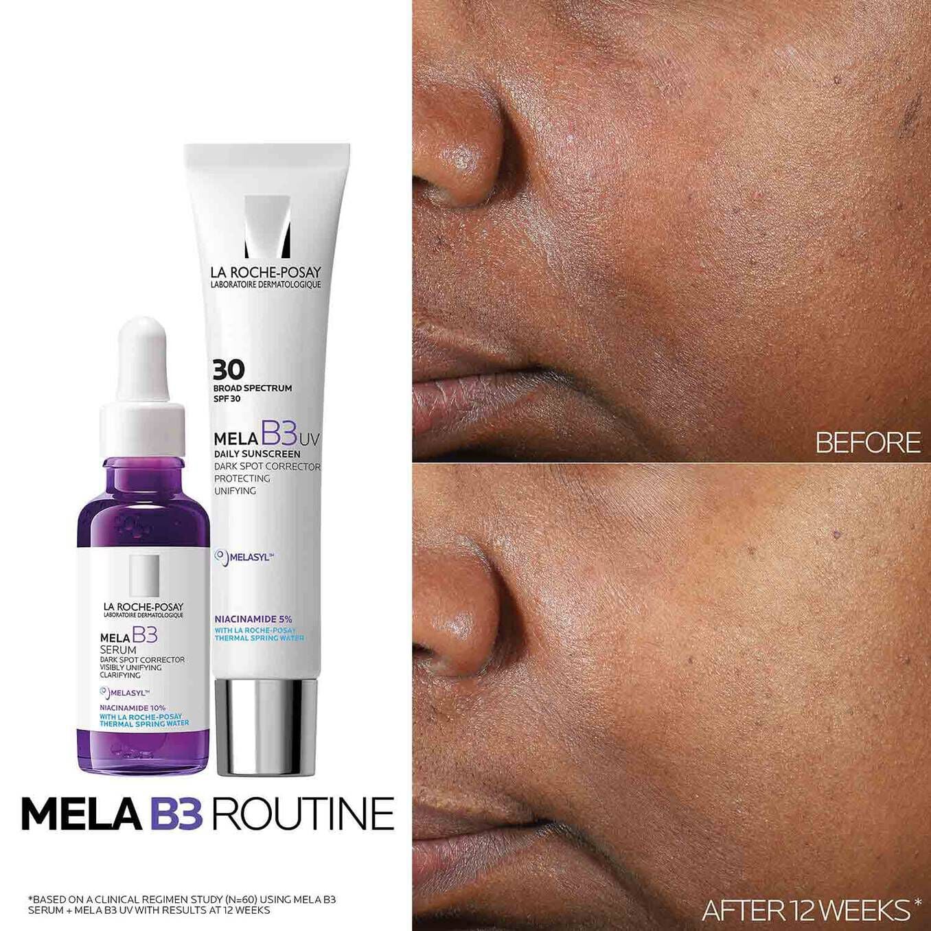 Mela B3 Dark Spot Serum & Mela B3 UV Daily Moisturizer With SPF 30 - Image 3