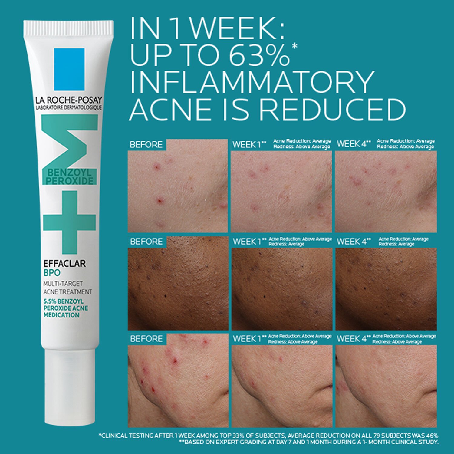 Effaclar BPO Multi-Target Acne Treatment with 5.5% Benzoyl Peroxide - Image 5